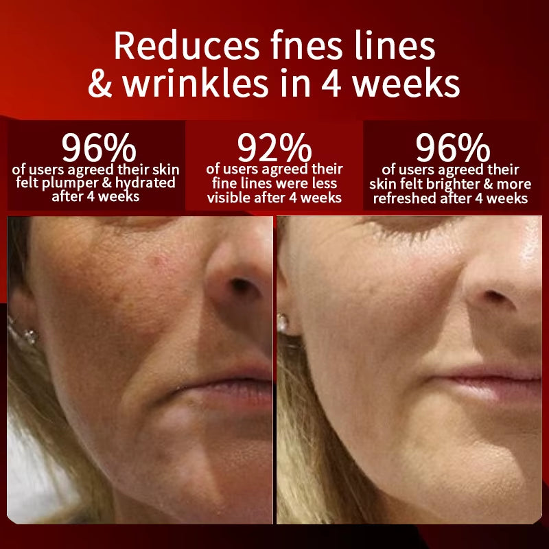 EYCO Red Light Photon Therapy Skin Care Mask Soft Medical Silicone Led Face Mask for Home Use